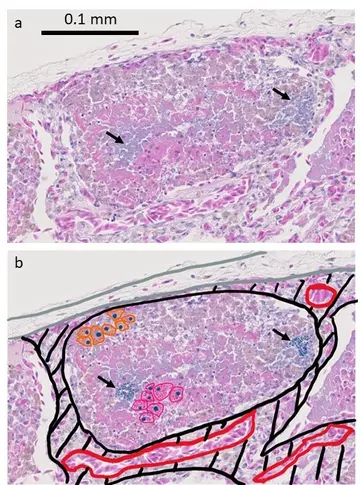 Histology of a diseased faveolus 